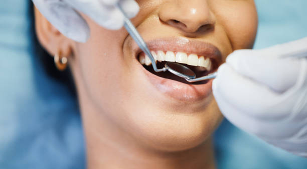 Best Teeth Whitening  in Parsons, KS